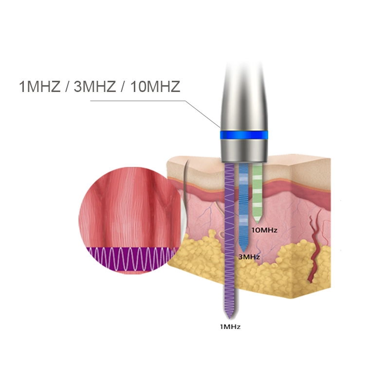 Echografie LDM Noblesse 10 MHz-therapie 3 in 1 ultrasone zonderimpel Verwijder schoonheidsmachine Gezichtsverzorgingsapparatuur met hoogfrequente ultrasone golven